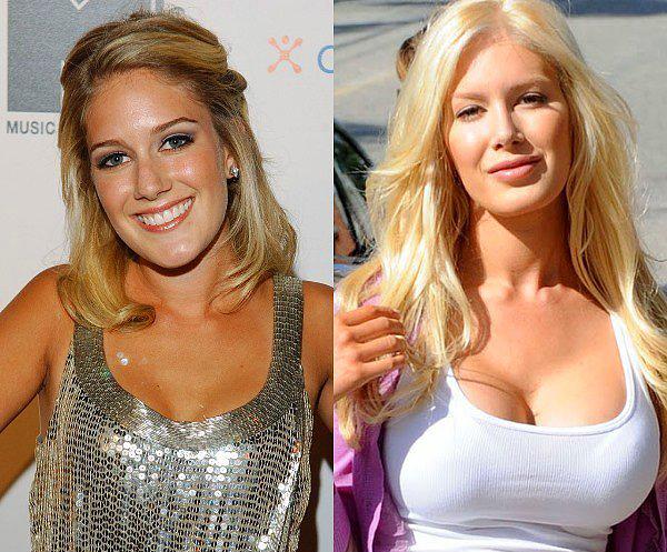 3.Heidi Montag Pratt