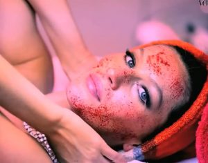 vampire-facelifting-gisele-bu%cc%88ndchen